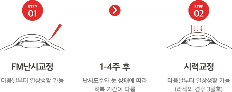 STEP01 FM난시교정 - 다음날부터 일상생활 가능 > 1-4주후 난시도수와 눈 상태에 따라 회복 기간이 다름 > STEP02 시력교정 - 다음날부터 일상생활 가능(라섹의 경우 3일후)