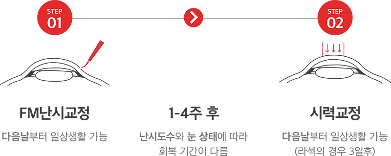 STEP01 FM난시교정 - 다음날부터 일상생활 가능 > 1-4주후 난시도수와 눈 상태에 따라 회복 기간이 다름 > STEP02 시력교정 - 다음날부터 일상생활 가능(라섹의 경우 3일후)